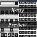 X-ray Film Preview 2.0
