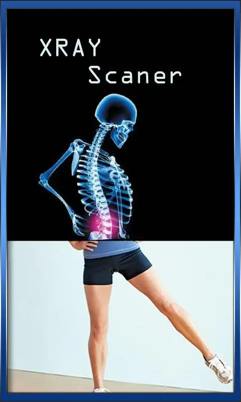 Xray Scanner Camera screenshot 2