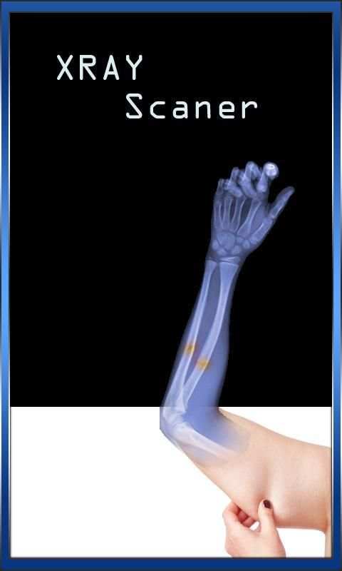 Xray Scanner Camera screenshot 10
