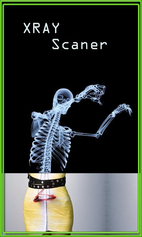 Xray Scanner Camera स्क्रीनशॉट 3