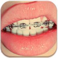 Braces Teeth Booth Pro on 9Apps