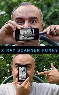 X ray Scanner Funny screenshot 6