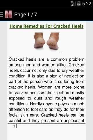 Get Rid of Cracked Heels स्क्रीनशॉट 2