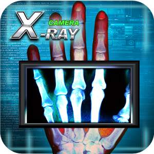 XRay Camera 2