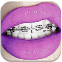 Braces- HD Camera Braces Booth иконка