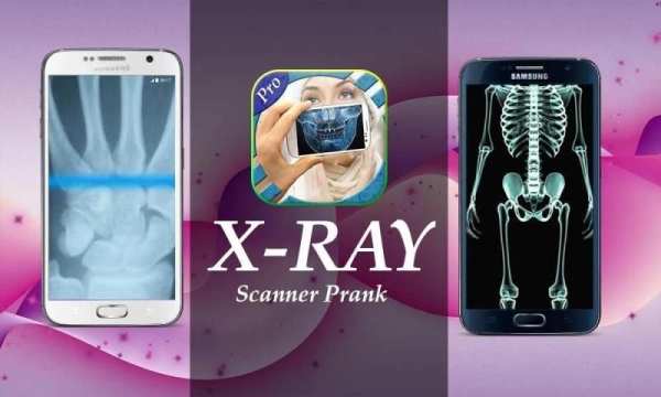 Xray camera Scanner Prank screenshot 3