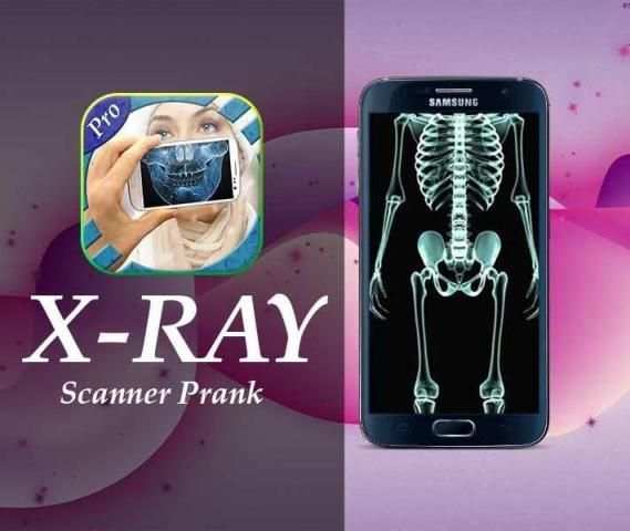 Xray camera Scanner Prank screenshot 1