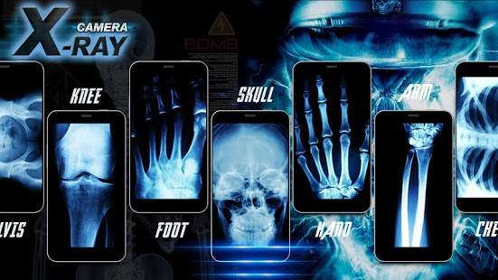 Xray Camera Prank screenshot 3