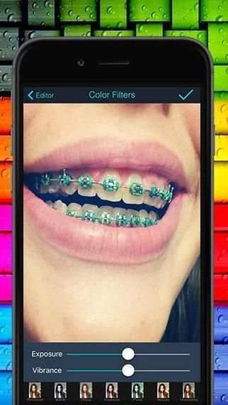 Real Braces teeth Camer Booth screenshot 2