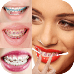 ikon Foto Behel Cakep