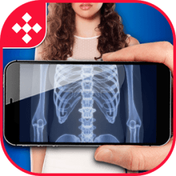 ikon X-Ray Full Body Scanner