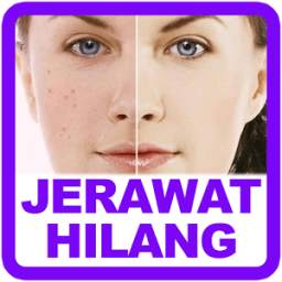 Cara Menghilangkan Jerawat 1.0