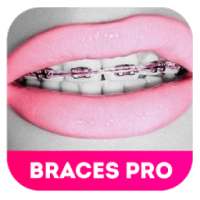 Braces Teeth Booth 2.0 on 9Apps