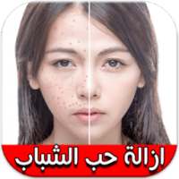 طرق إزالة حب الشباب "بدون نت" on 9Apps