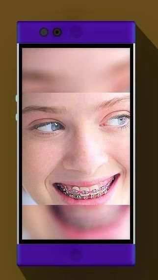 Real Braces Booth HD Studio скриншот 3