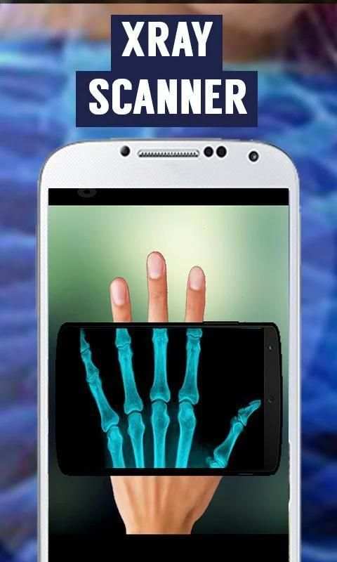Xray Camera Scanner 2 تصوير الشاشة