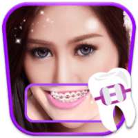 Braces Teeth Booth on 9Apps