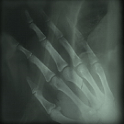 #X Ray Live Wallpaper icon