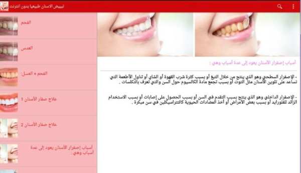 تبييض الاسنان طبيعيا بدون نت screenshot 1