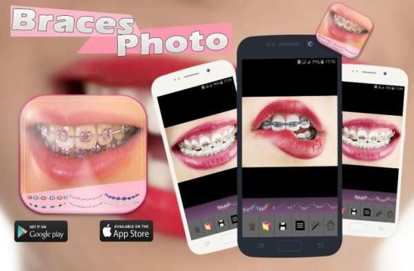 Braces Photo Booth screenshot 2