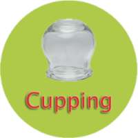 Cupping Guide