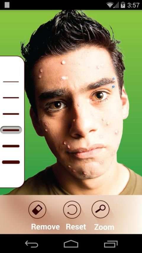 Pimple Remover screenshot 1