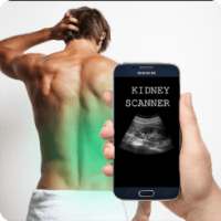 Kidney Scanner Prank