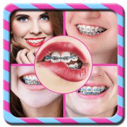 Brace Photo Effets 1.1