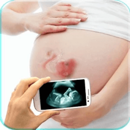 Ultrasound X ray Scanner Prank आइकन