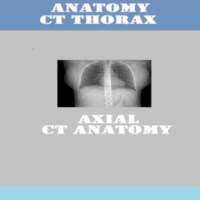 ANATOMY OF CHEST CT