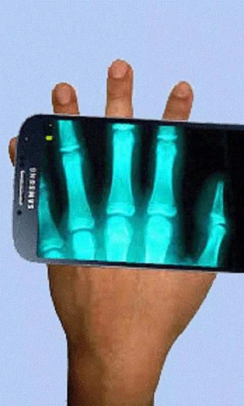 Xray Scanner скриншот 1