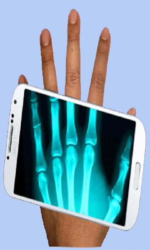 Xray Scanner скриншот 3