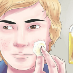 Como eliminar el acné आइकन