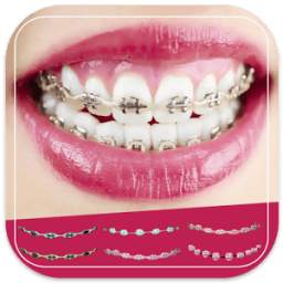 Brace Photo Editor Beauty Plus 1.0