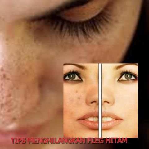 Tips Cara Hilangkan Flek Hitam screenshot 1