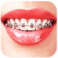 Braces: Real Teeth Braces Pict on 9Apps