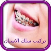 تركيب الاسنان - تقويم الأسنان