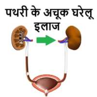 Kidney Stone पथरी केघरेलू इलाज on 9Apps