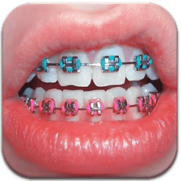 Real Braces Booth HD Studio иконка