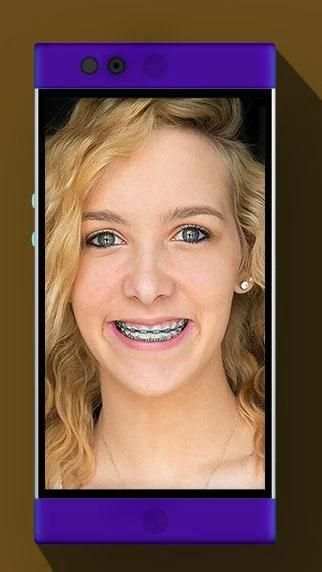 Real Braces Booth HD Studio скриншот 4