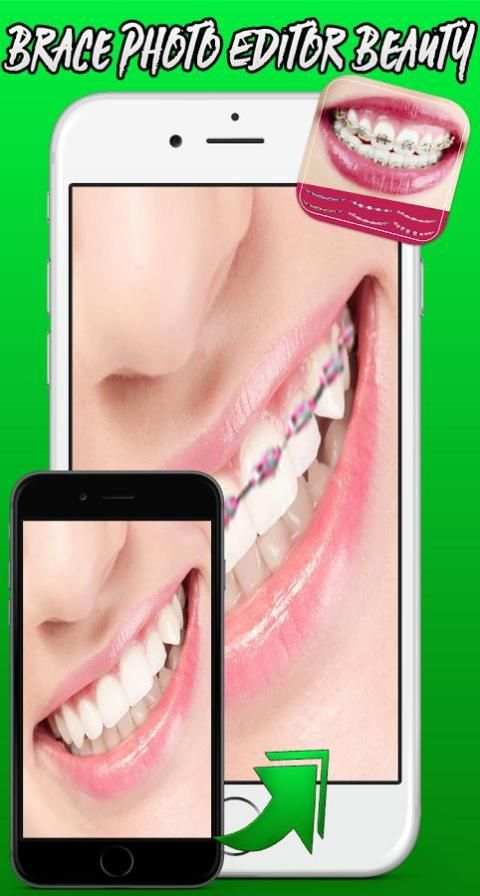 Brace Photo Editor Beauty Plus screenshot 4