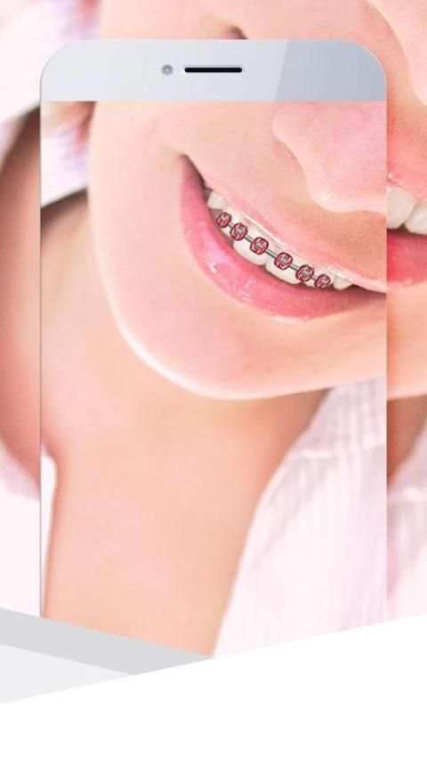 Beauty Braces Cam screenshot 1