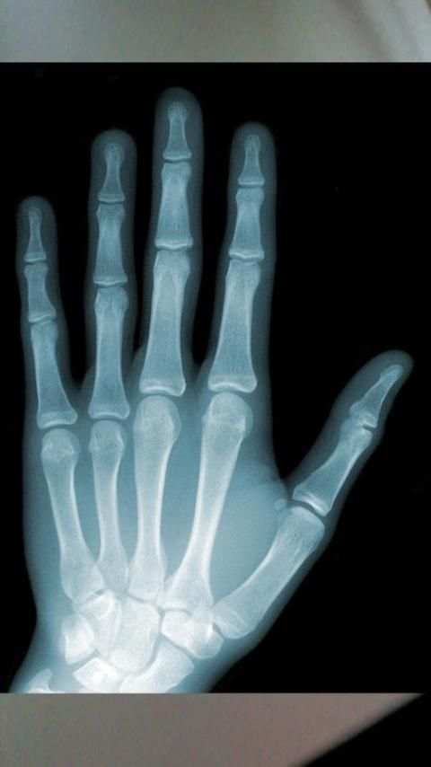 X-Ray Scanner HD Prank 6 تصوير الشاشة