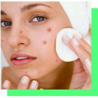 Eliminar rosacea on 9Apps