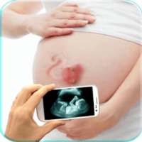 Ultrasound X ray Scanner Prank on 9Apps