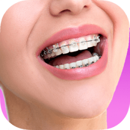 ikon Top Design Braces teeth