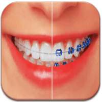 Braces Teeth Booth Maker Pro