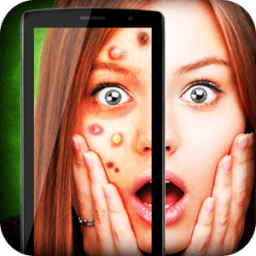 Face add pimple joke icon