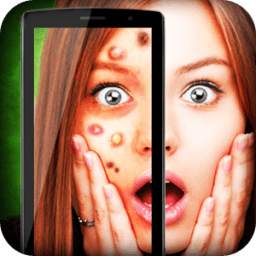 Face add pimple joke 1.0