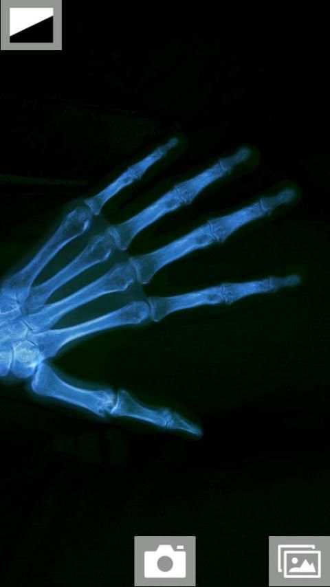 Super XRay Camera स्क्रीनशॉट 1